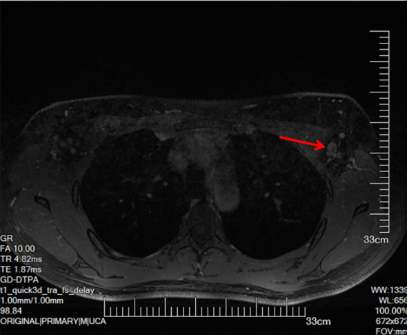 Key image 3