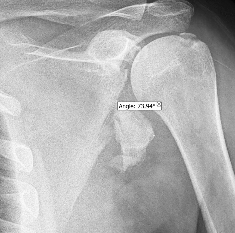 Key image 1