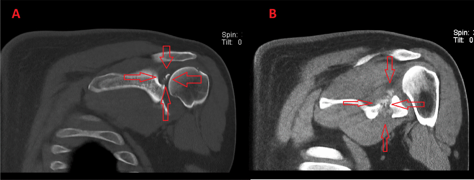 Key image 2