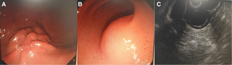 Key image 1