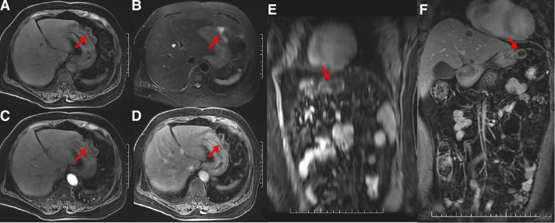 Key image 3
