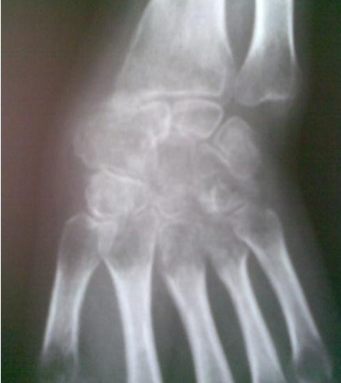 Key image 1