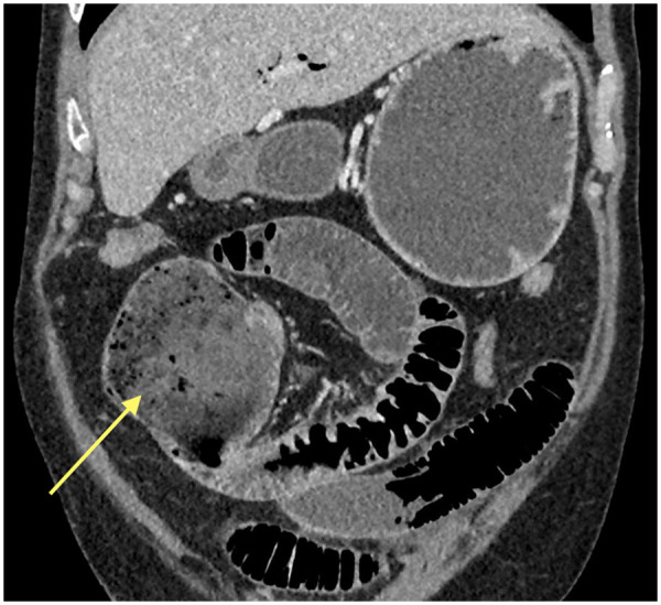 Key image 1
