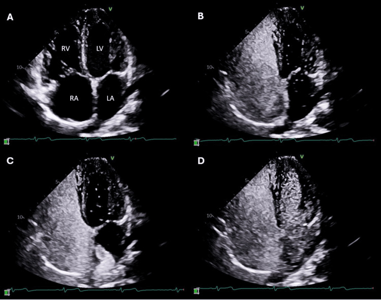 Key image 1