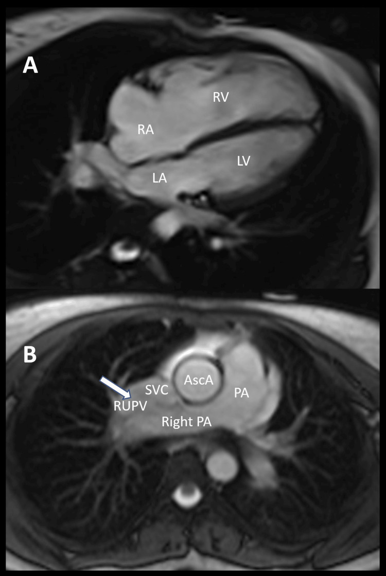 Key image 2