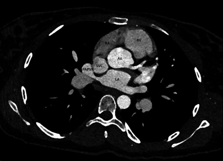 Key image 3