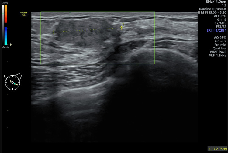 Key image 1