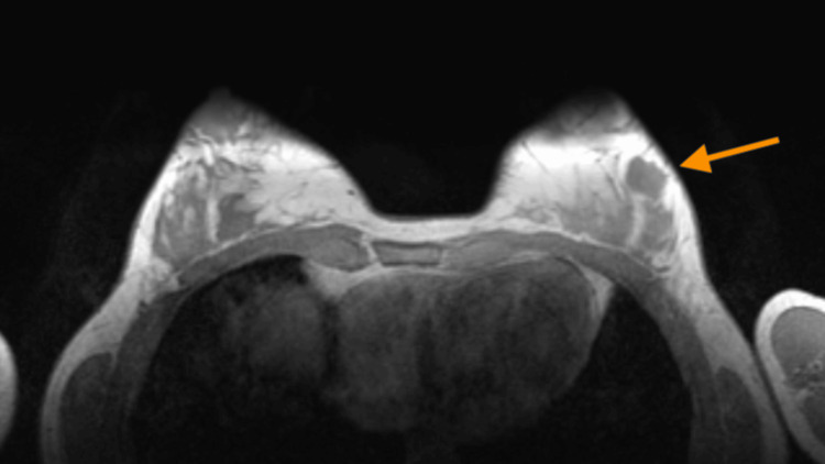 Key image 3