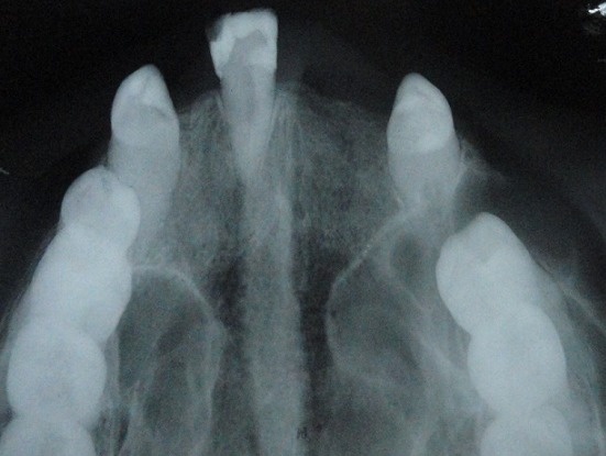 Key image 1