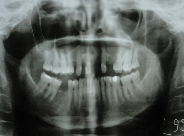Key image 2