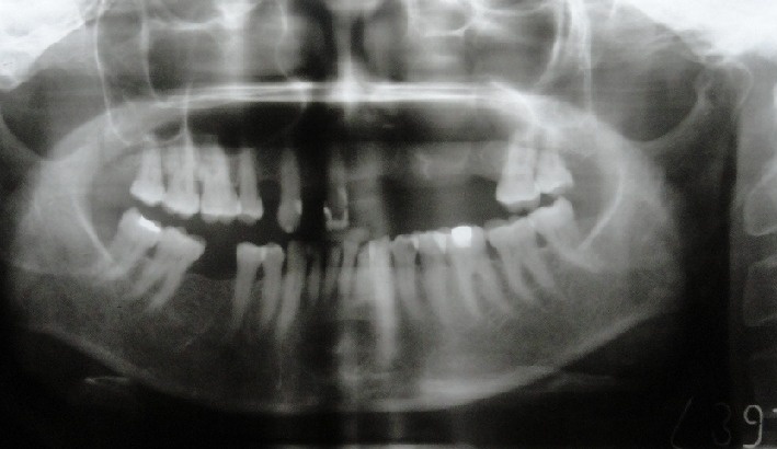 Key image 3