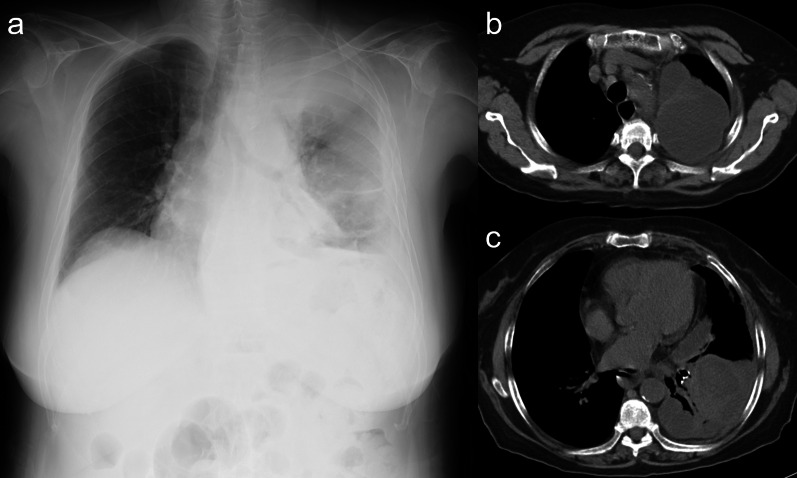 Key image 1