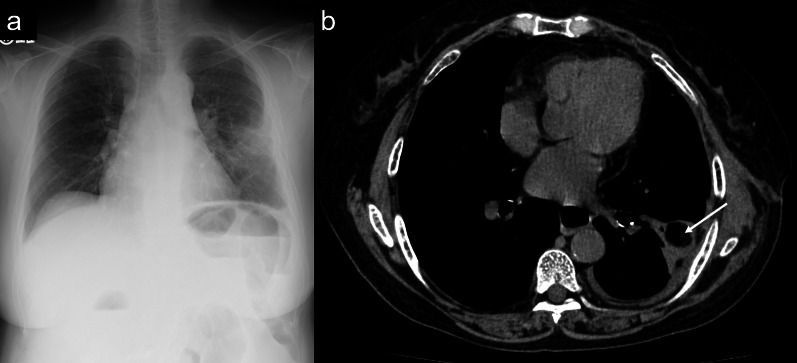 Key image 3