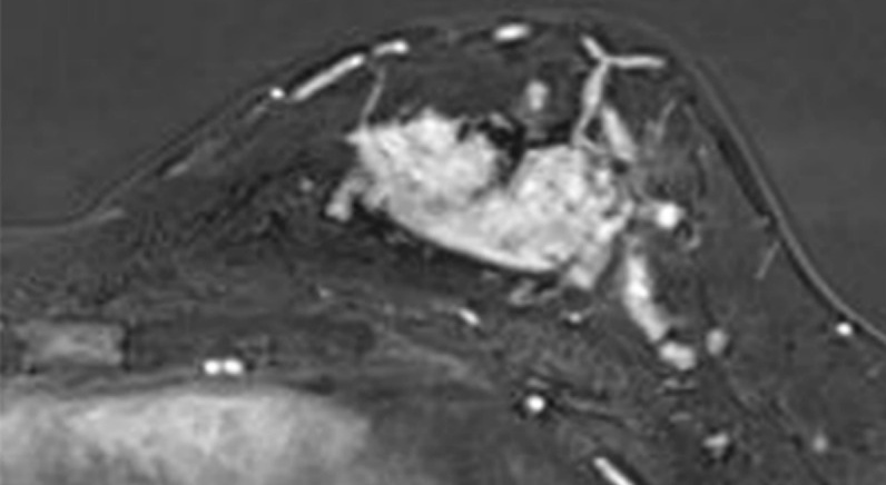 Key image 1