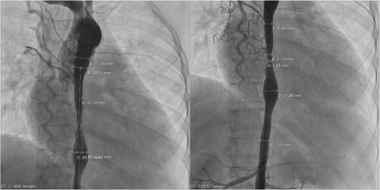 Key image 2