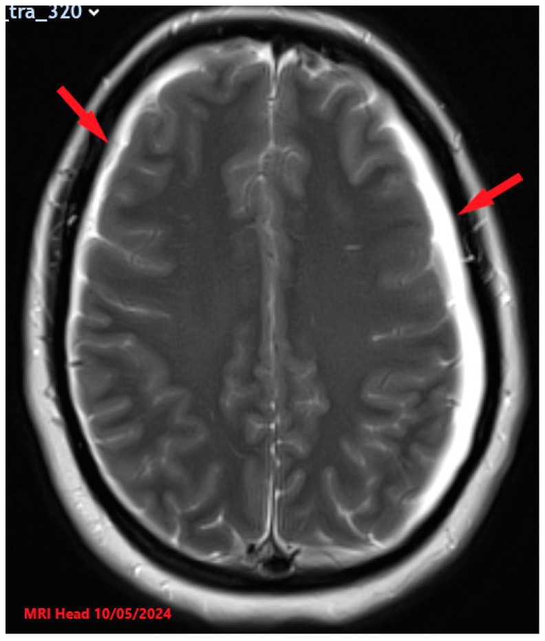 Key image 1