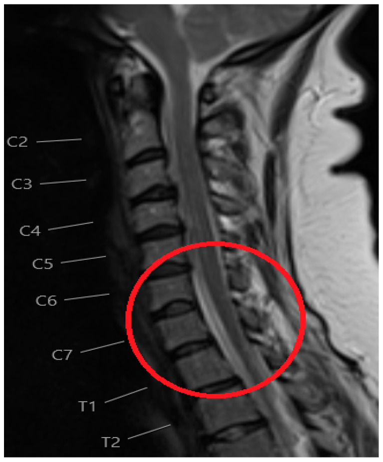 Key image 2