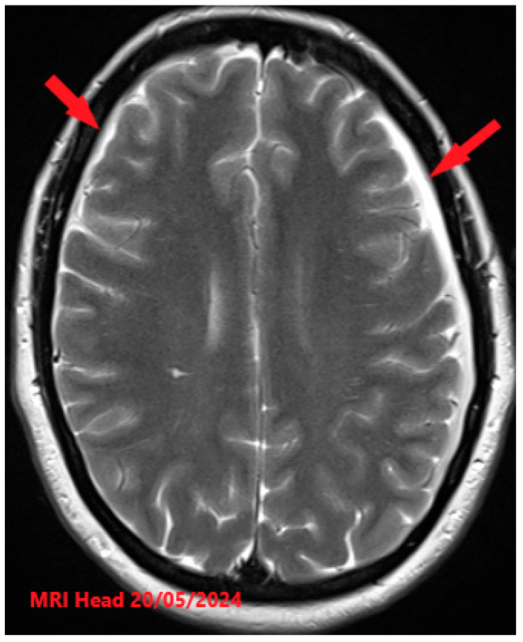Key image 3