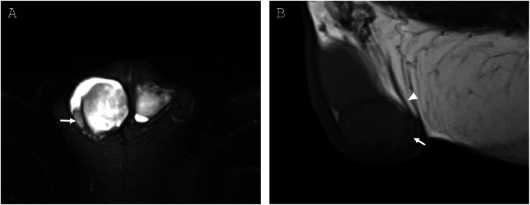 Key image 3