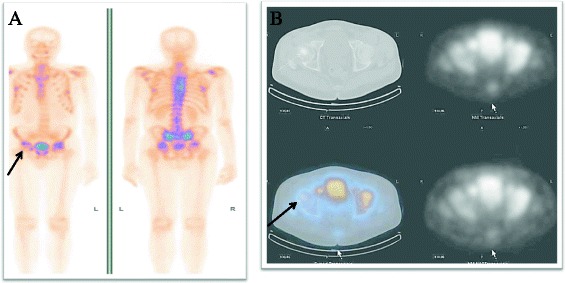 Key image 1