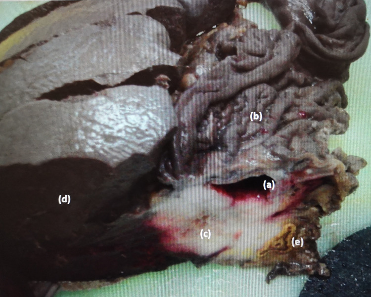 Key image 2