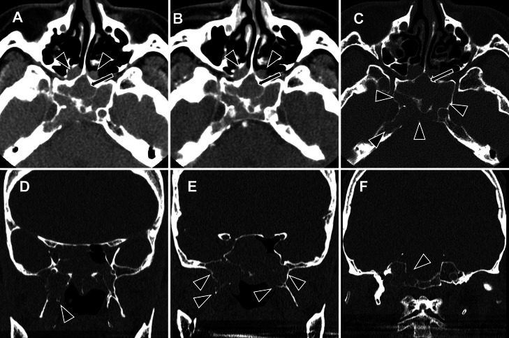 Key image 1