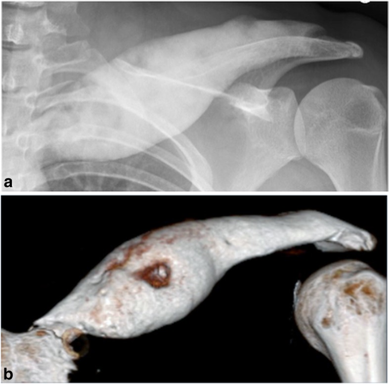Key image 1