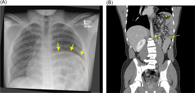 Key image 1