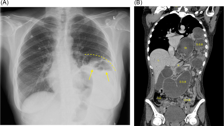 Key image 3