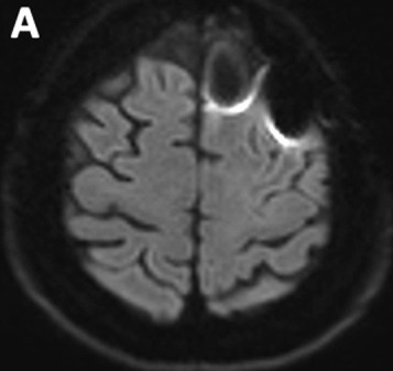Key image 1