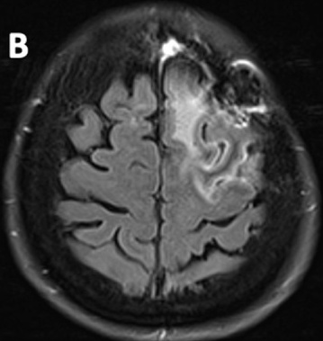 Key image 2