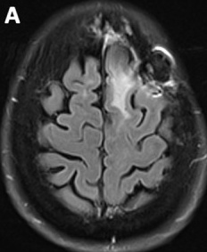 Key image 3