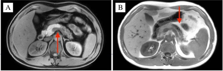 Key image 1