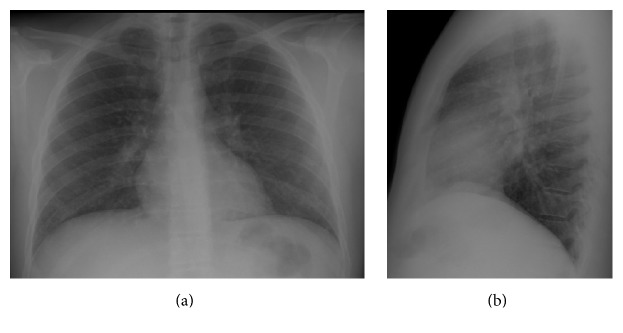 Key image 1