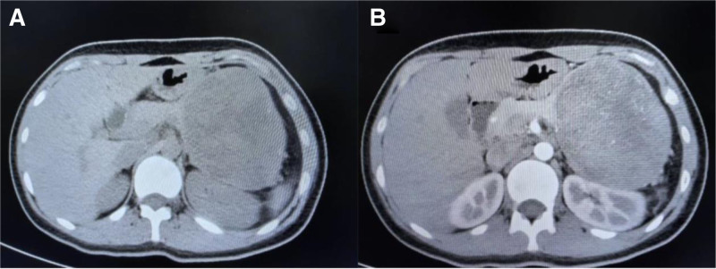 Key image 1