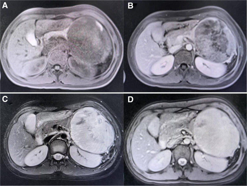 Key image 2