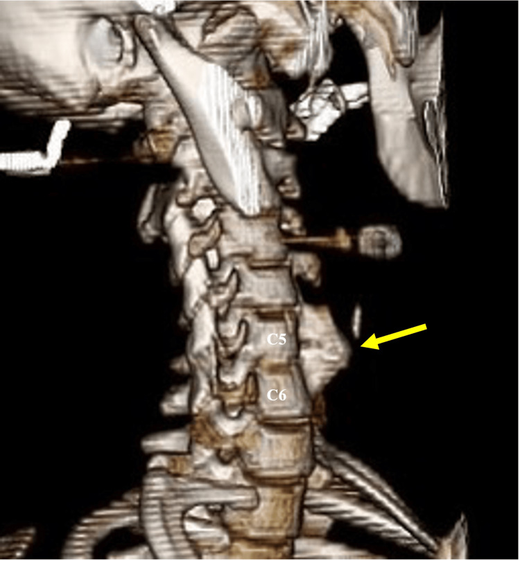Key image 2