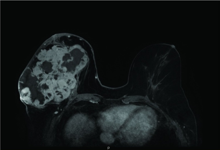 Key image 1