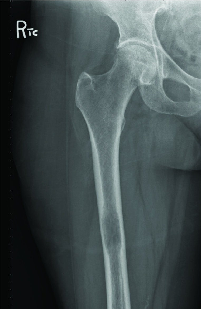 Key image 2