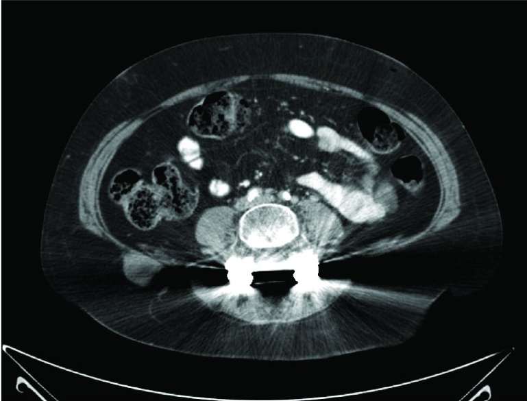 Key image 3