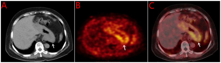 Key image 3