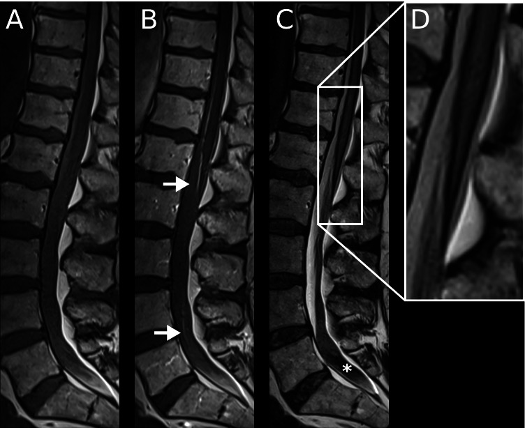 Key image 3