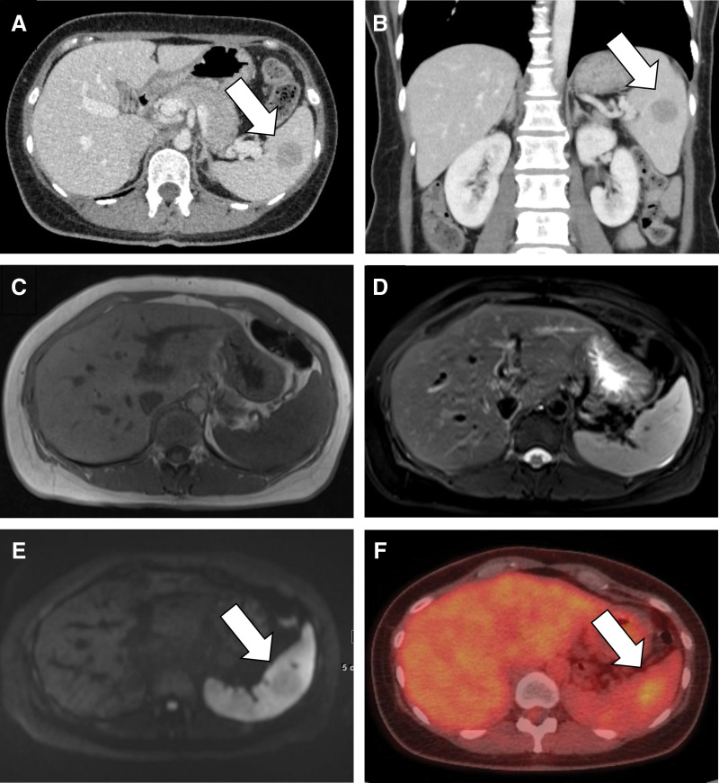Key image 1