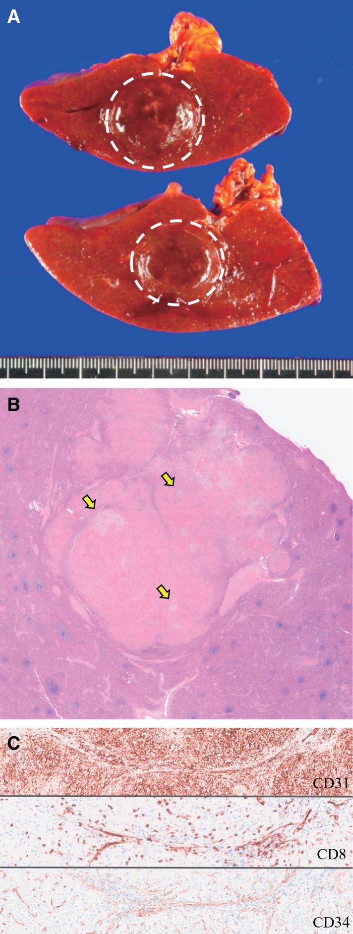 Key image 2