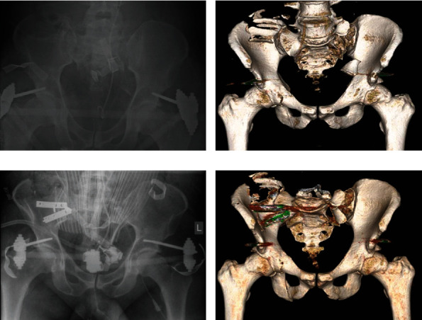 Key image 2