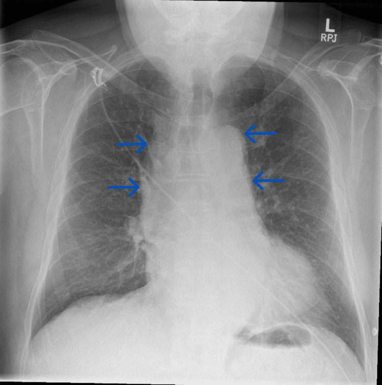 Key image 2