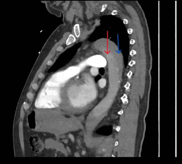 Key image 3