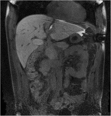 Key image 2