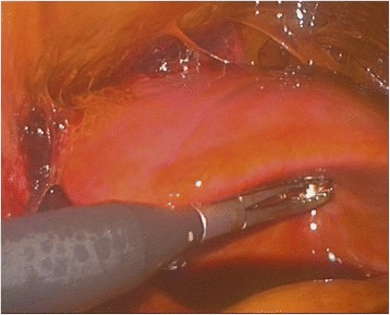 Key image 3
