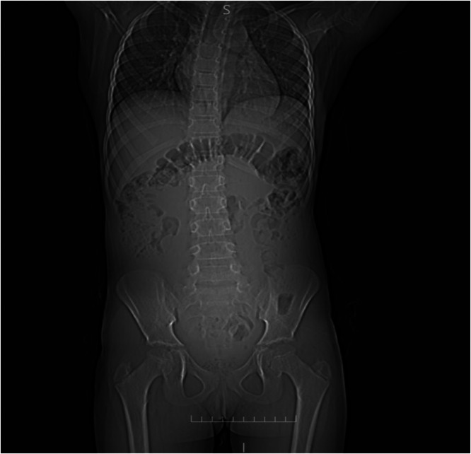 Key image 1